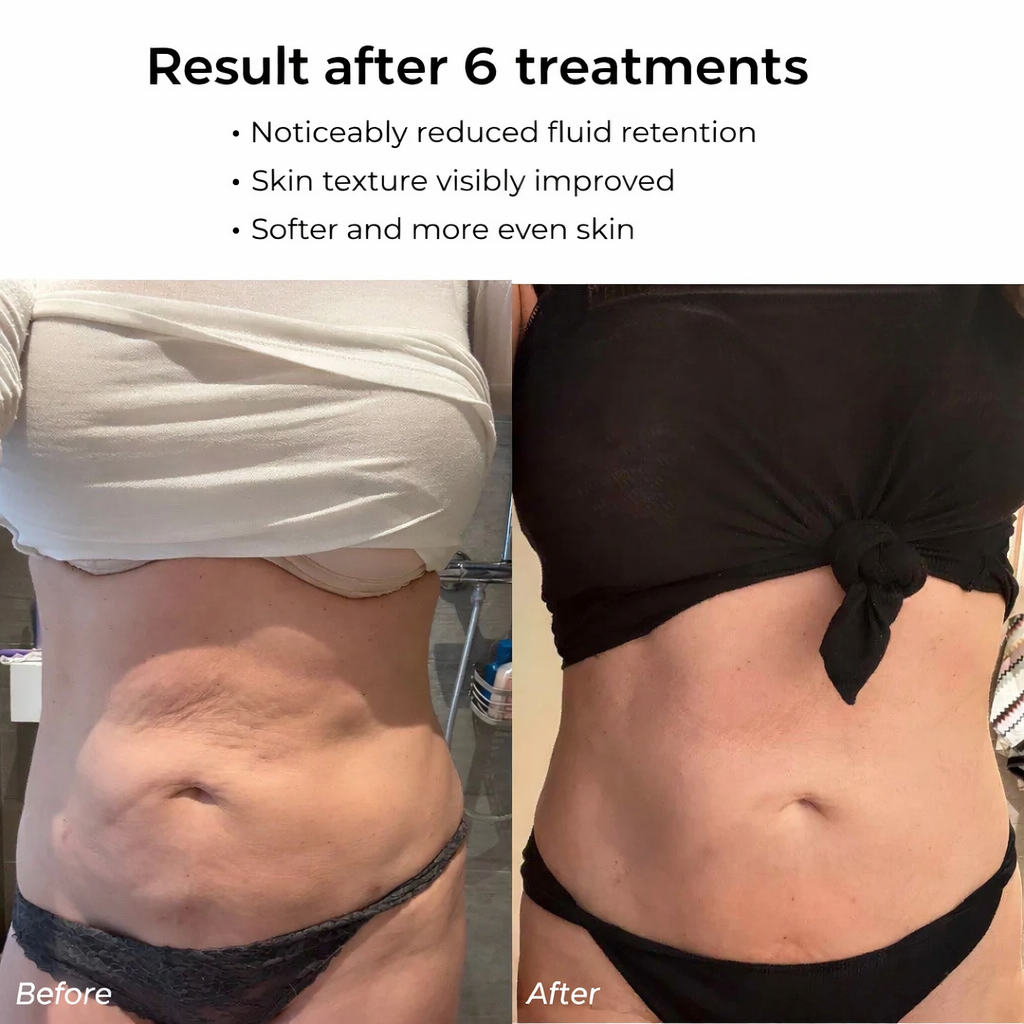 GIGI Pro™ - Une peau plus ferme et plus tonique